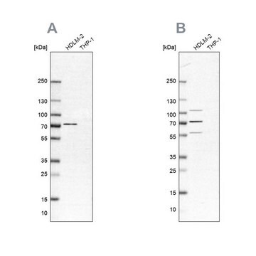 Anti-EIF2AK2 antibody produced in rabbit Prestige Antibodies&#174; Powered by Atlas Antibodies, affinity isolated antibody, buffered aqueous glycerol solution