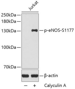 Anti-Phospho-eNOS-S1177 antibody produced in rabbit