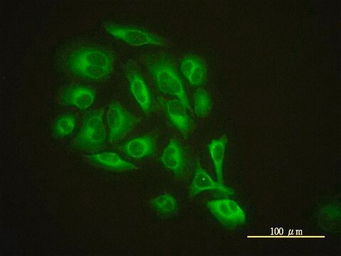 Monoclonal Anti-GMFB antibody produced in mouse clone 2G12-2A2, purified immunoglobulin, buffered aqueous solution