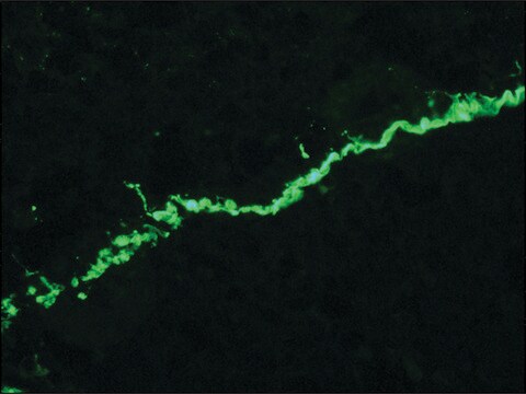 抗胶原蛋白VII型抗体，小鼠单克隆 clone LH7.2, purified from hybridoma cell culture