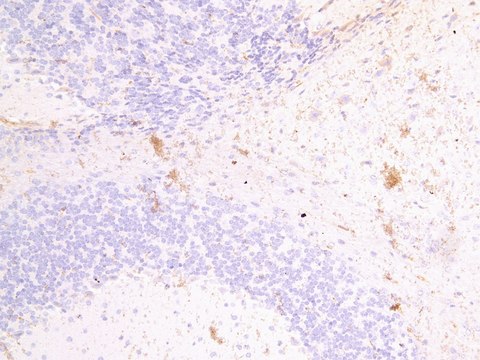 Anti-FSCN2 antibody produced in goat affinity isolated antibody, buffered aqueous solution