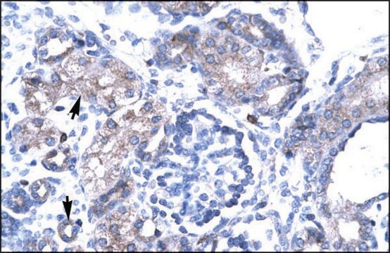 抗-TBX19 兔抗 IgG fraction of antiserum