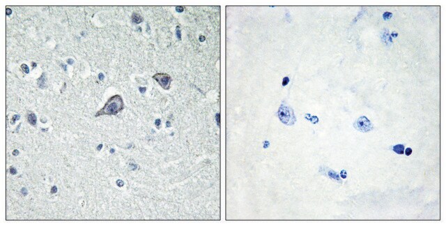 Anti-ADORA2A antibody produced in rabbit affinity isolated antibody