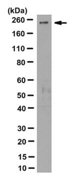 Anticorpo anti-PIKFYVE, clone R159.4.3C9 clone R159.4.3C9, from mouse