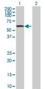 Anti-CES1 antibody produced in rabbit purified immunoglobulin, buffered aqueous solution