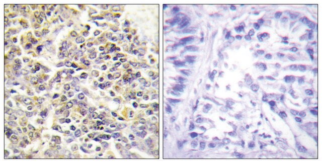 抗-ASC 兔抗 affinity isolated antibody