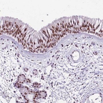 Anti-TBC1D26 antibody produced in rabbit Prestige Antibodies&#174; Powered by Atlas Antibodies, affinity isolated antibody, buffered aqueous glycerol solution