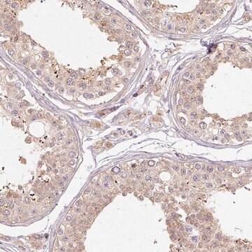 Anti-RB1CC1 antibody produced in rabbit Prestige Antibodies&#174; Powered by Atlas Antibodies, affinity isolated antibody, buffered aqueous glycerol solution