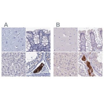 Anti-CYP51A1 antibody produced in rabbit Prestige Antibodies&#174; Powered by Atlas Antibodies, affinity isolated antibody, buffered aqueous glycerol solution