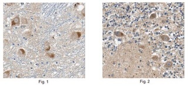 Anti-SQSTM1 Antibody, clone 20F1.1 clone 20F1.1, from mouse