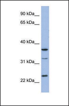 Anti-SOX21 antibody produced in rabbit affinity isolated antibody