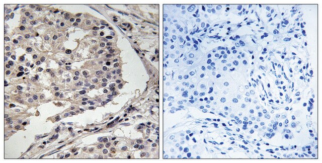 Anti-MLK1 antibody produced in rabbit affinity isolated antibody