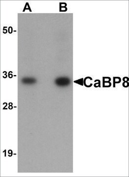 Anti-CaBP8 antibody produced in rabbit affinity isolated antibody, buffered aqueous solution