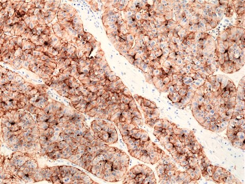 Królicze przeciwciało monoklonalne anty-CD73 clone RM431, affinity purified immunoglobulin