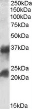 抗CTLA/CTLB抗体 ヤギ宿主抗体 affinity isolated antibody, buffered aqueous solution