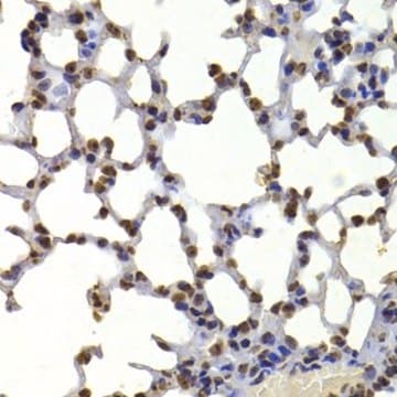 Anti- HP1 alpha/CBX5 antibody produced in rabbit