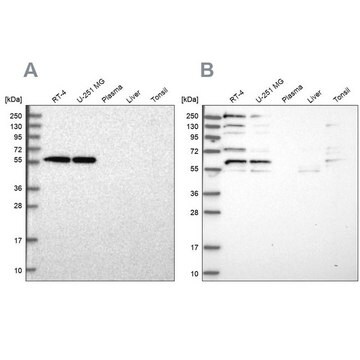 Anti-SAAL1 antibody produced in rabbit Prestige Antibodies&#174; Powered by Atlas Antibodies, affinity isolated antibody