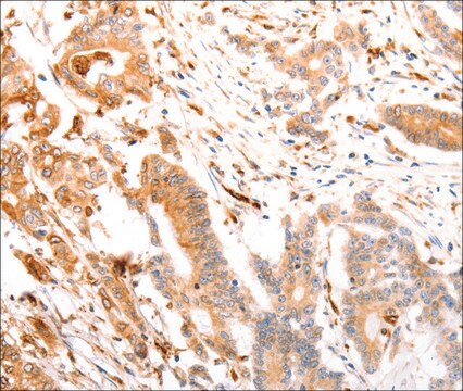 Anty-ABCA4 affinity isolated antibody