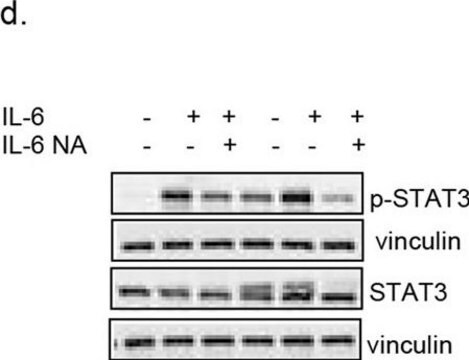 Anticorpo anti-vinculina, clone V284 clone V284, Upstate&#174;, from mouse