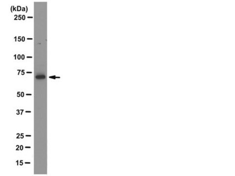 Anti-LIMK1 Antibody, clone 40/00-1B11-1-1 clone 40/00-1B11-1-1, from rat