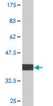 Monoclonal Anti-UBE4B, (C-terminal) antibody produced in mouse clone 1D5, purified immunoglobulin, buffered aqueous solution