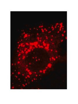 Anti-TPP1 Antibody, clone 2E12 clone 2E12, from mouse