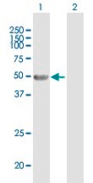 Anti-ANGPTL4 antibody produced in mouse purified immunoglobulin, buffered aqueous solution