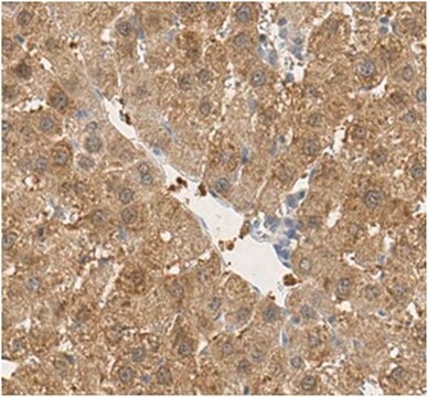 Anti-FABP1 Antibody from rabbit, purified by affinity chromatography