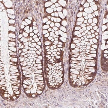 Anti-HFE antibody produced in rabbit Prestige Antibodies&#174; Powered by Atlas Antibodies, affinity isolated antibody, buffered aqueous glycerol solution