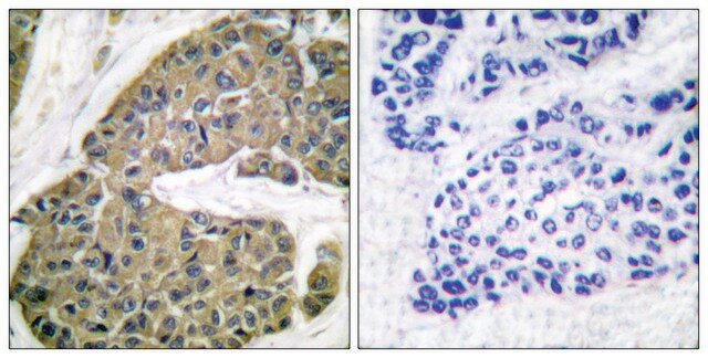 Anti-Keratin 5 antibody produced in rabbit affinity isolated antibody