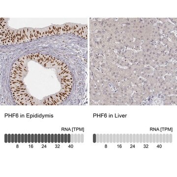 Anti-PHF6 antibody produced in rabbit affinity isolated antibody, buffered aqueous glycerol solution