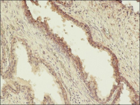 モノクロナール抗リン酸化トレオニン マウス宿主抗体 clone PTR-8, ascites fluid