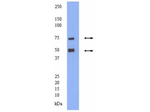 Anticorpo anti-trasportatore della dopamina; 100 &#181;g from rabbit