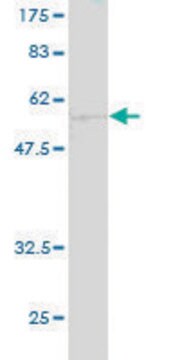 ANTI-CA1 antibody produced in mouse clone 1E11, purified immunoglobulin, buffered aqueous solution