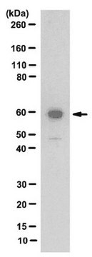 Anti-Thyroid Hormone Receptor &#946;-1 Antibody from rabbit, purified by affinity chromatography