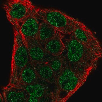 抗SOCS1抗体 ウサギ宿主抗体 Prestige Antibodies&#174; Powered by Atlas Antibodies, affinity isolated antibody