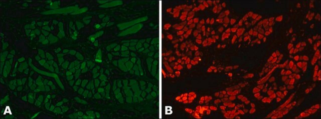 抗ミオシン（骨格、速筋型）抗体、マウスモノクロナール clone MY-32, purified from hybridoma cell culture