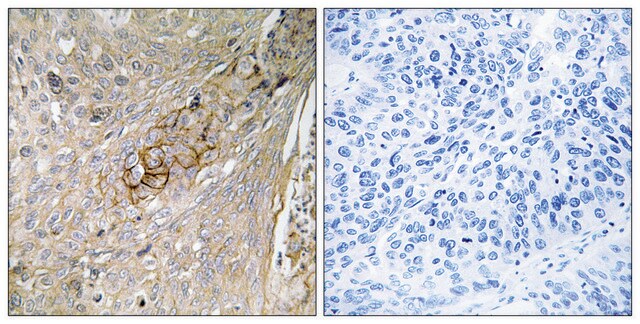 Anti-SLC6A6 antibody produced in rabbit affinity isolated antibody