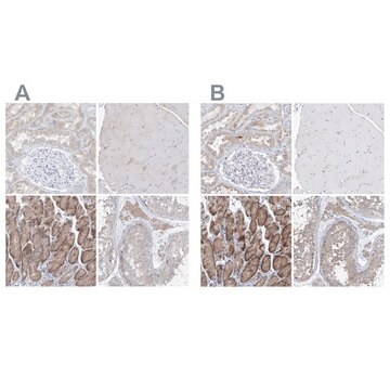 Anti-UFL1 antibody produced in rabbit Prestige Antibodies&#174; Powered by Atlas Antibodies, affinity isolated antibody, buffered aqueous glycerol solution, ab2