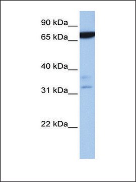 Anti-ZBTB46 antibody produced in rabbit affinity isolated antibody