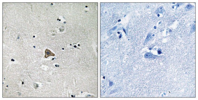 Anti-Claudin 4 antibody produced in rabbit affinity isolated antibody