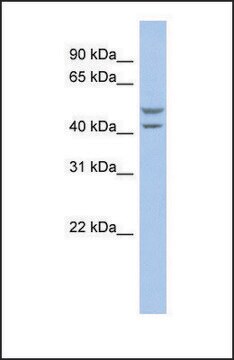 Anti-SLC37A4 antibody produced in rabbit affinity isolated antibody