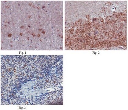 Anti-C-X-C-Chemokinrezeptor Typ 5(CXCR5)-Antikörper from rabbit, purified by affinity chromatography