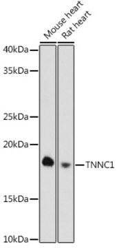 Anti-TNNC1 Antibody, clone 8Z4V9, Rabbit Monoclonal