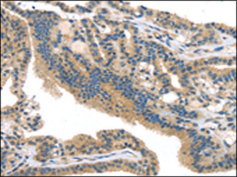 Anti-SMYD3 affinity isolated antibody