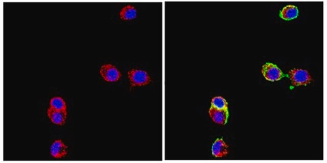 Anticuerpo anti-molécula de adhesión neuronal L1, clon 324 clone 324, Chemicon&#174;, from rat