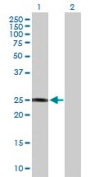 Anti-GSTZ1 antibody produced in mouse purified immunoglobulin, buffered aqueous solution