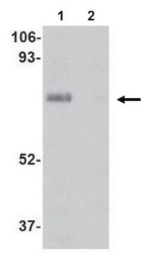 Anti-LIMP II Antibody from rabbit, purified by affinity chromatography