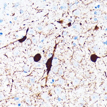 Anti-Parvalbumin (PVALB) Antibody, clone 6C7K6, Rabbit Monoclonal