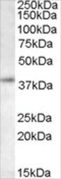 Anti-RNF2/DING antibody produced in goat affinity isolated antibody, buffered aqueous solution